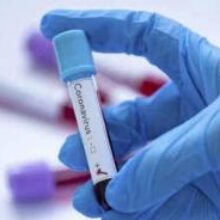 Коронавирус мутирует, «приспосабливаясь» к людям. К чему это приведет?