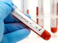 Частные лаборатории и клиники с начала эпидемии COVID-19 провели 3900 ПЦР-тестов, выявили 198 случаев заболевания – Степанов