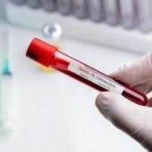 Хорошие новости: коронавирус SARS-CoV-2 стабилен и плохо мутирует