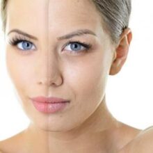Чем заменить ботокс: доступные методы омоложения кожи