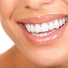 6 фактов в пользу виниров