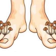 Для лечения грибковых инфекций может появиться более эффективное средство