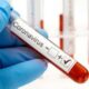 В США одобрили 1-й тест на коронавирус, который можно проводить самостоятельно в домашних условиях
