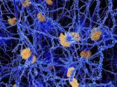 Бета-амилоиды из мозга людей с болезнью Альцгеймера оказались непохожи на лабораторный аналог