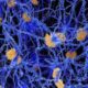 Бета-амилоиды из мозга людей с болезнью Альцгеймера оказались непохожи на лабораторный аналог