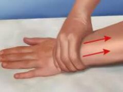 Лимфостаз руки после удаления молочной железы: симптомы и лечение