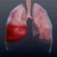 Пневмония без кашля и температуры: как распознать опасное заболевание у ребенка