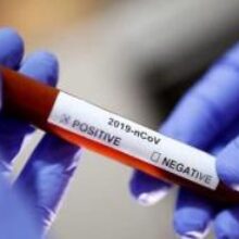 Это наш путь к свободе: Словакия начала программу массового тестирования на коронавирус