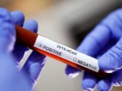 Это наш путь к свободе: Словакия начала программу массового тестирования на коронавирус