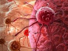 Рак яичников, простаты и молочной железы: как они передаются по наследству