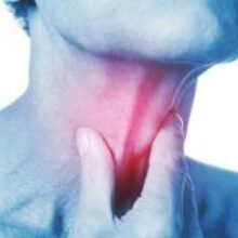 Коварная ангина: почему не стоит заниматься самолечением