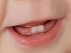 Могут ли зубы прорезываться без боли: лайфхаки для мам