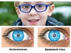 У кого развивается астигматизм и помогут ли очки, контактные линзы