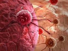 Медики раскрыли статистику склонности людей к раку