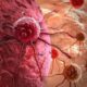 Медики раскрыли статистику склонности людей к раку