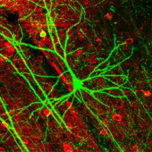 Выключение трех ферментов спасло нейроны от смерти