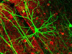 Выключение трех ферментов спасло нейроны от смерти