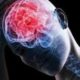 Ученые назвали факторы смертельного исхода после травмы мозга