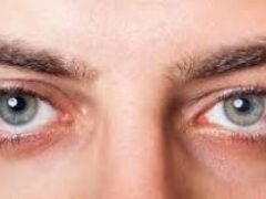 6 болезней глаз, которые провоцирует солнце